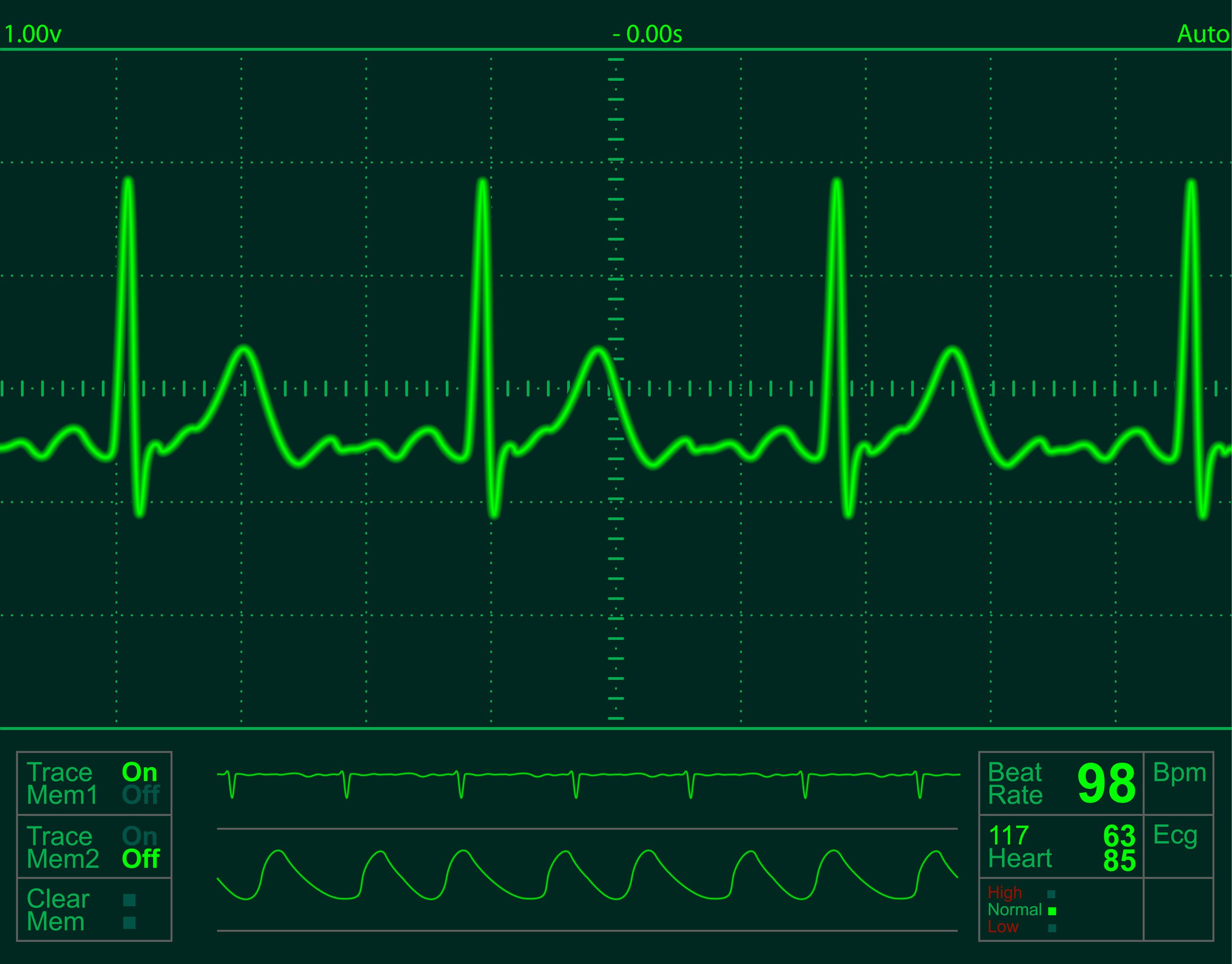 Qardio ECG Monitor Streams Data To Your IPhone