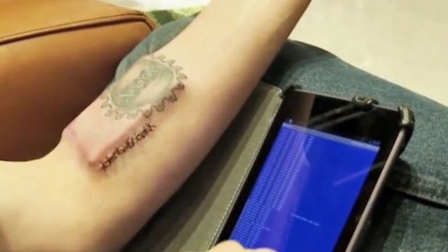 Biohacker Implants Smartphone Sized Chip Under His Arm