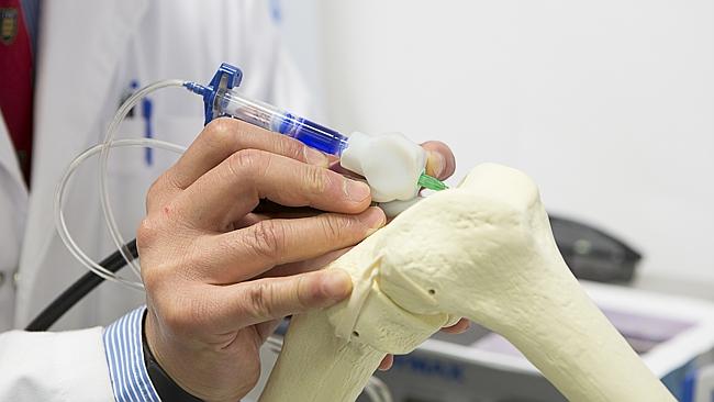 BioPen Lets Surgeons “Draw” Bones