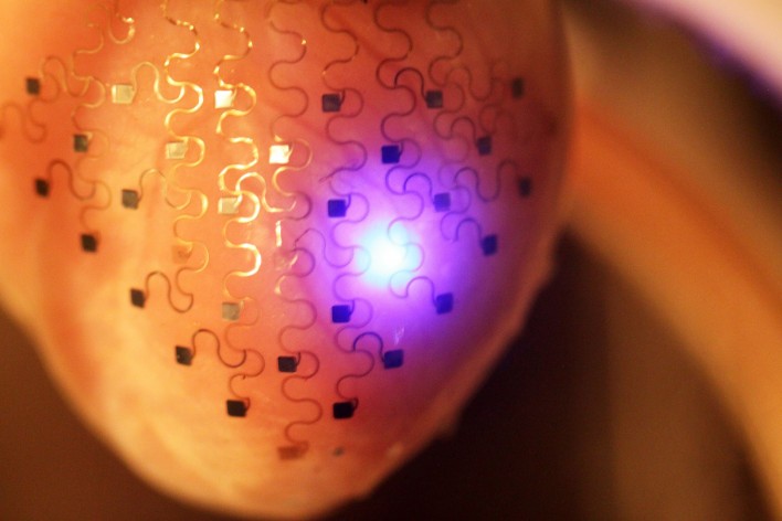 Electronic Membrane Created To Keep Your Heart Beating Forever