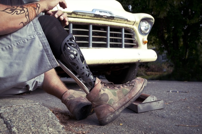 Man Turns To Kickstarter to Crowdfund 3D Printed Parts For His Prosthetic Leg